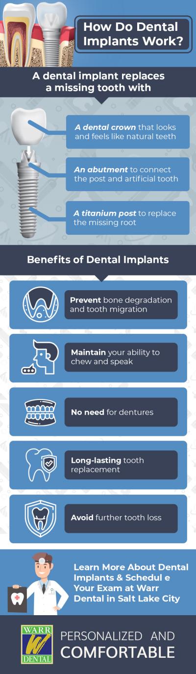 Graphic for Dental Implants in Salt Lake City, UT